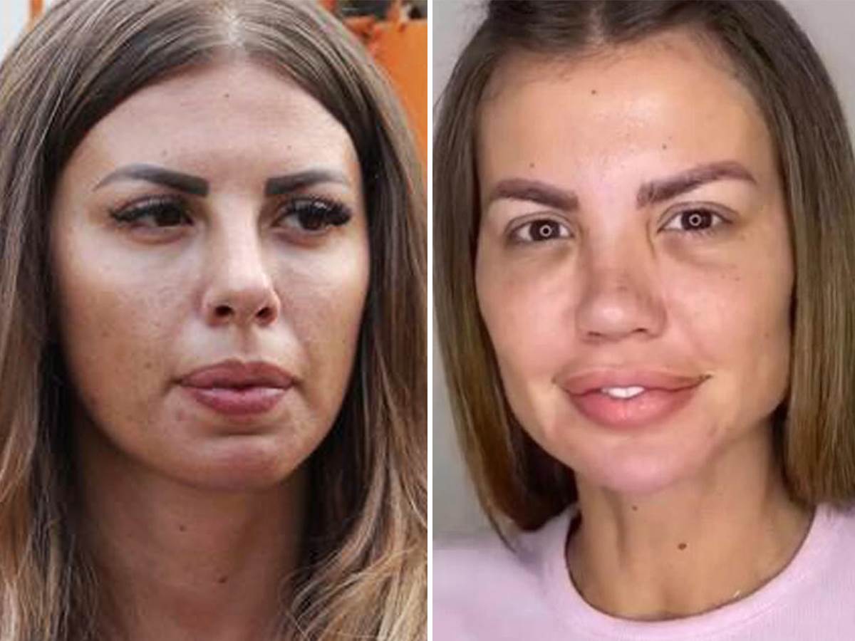 Dragana Mitar o sedmoj operaciji nosa | Mondo