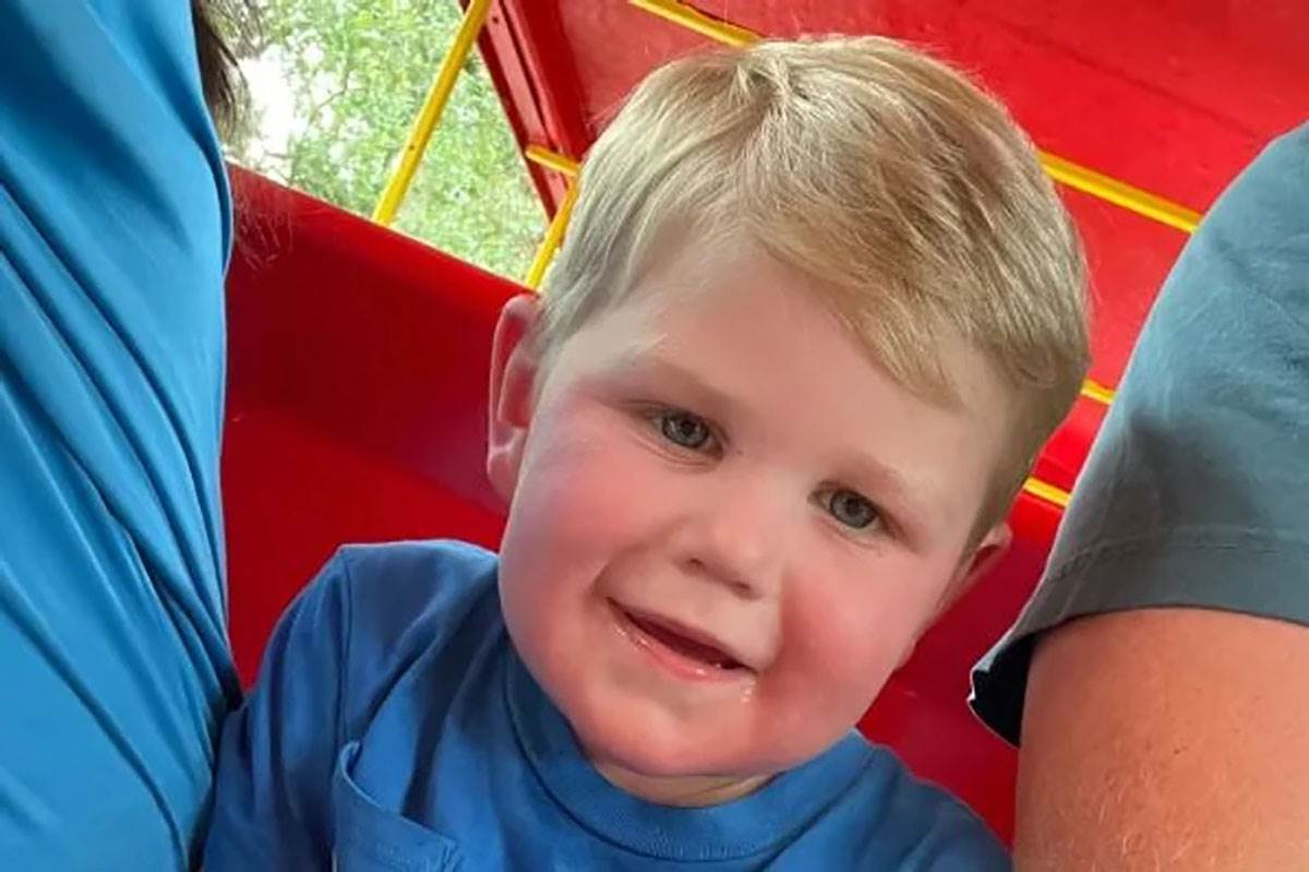 Dečaka (2) napao roj osa | Mondo