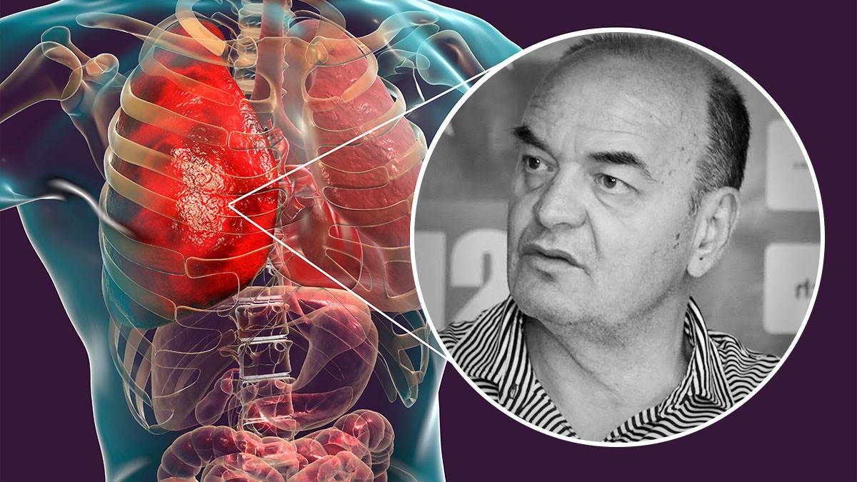 Simptomi upale pluća zbog koje je Duško Vujošević primljen u Urgentni