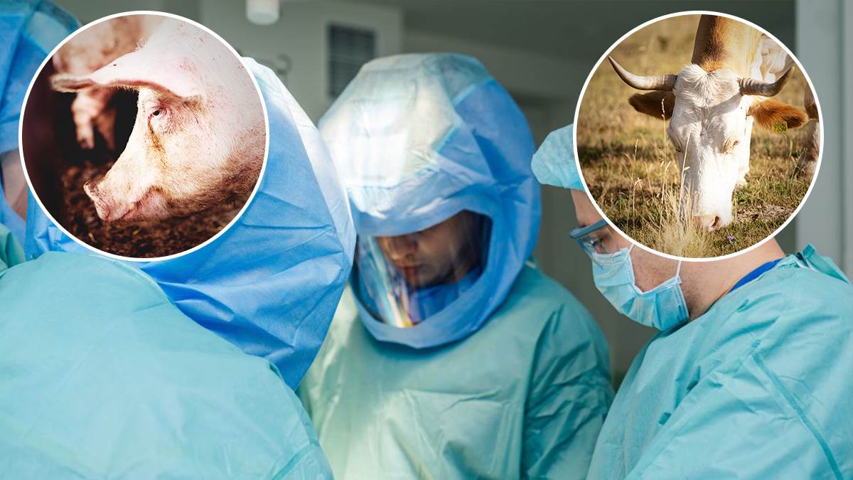 Zemlja odobrila transplantaciju životinjskih organa kod ljudi: U slučaju infekcije sledi ovo