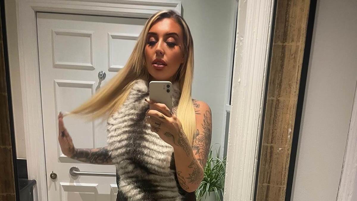 Influenserka pala s balkona hotela: Slomila kičmu na 24 mesta, a ruke joj potpuno uništene