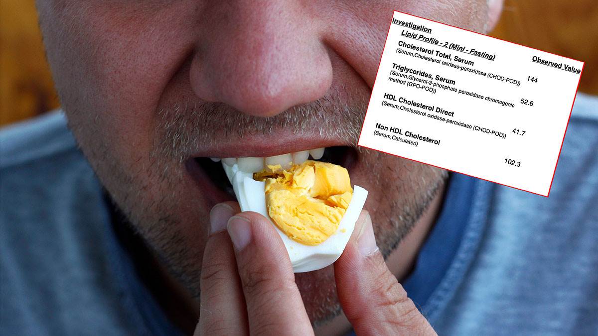 Doktor jede 28 jaja nedeljno: Javno objavio impresivne rezultate krvi, pogledajte holesterol (Foto)