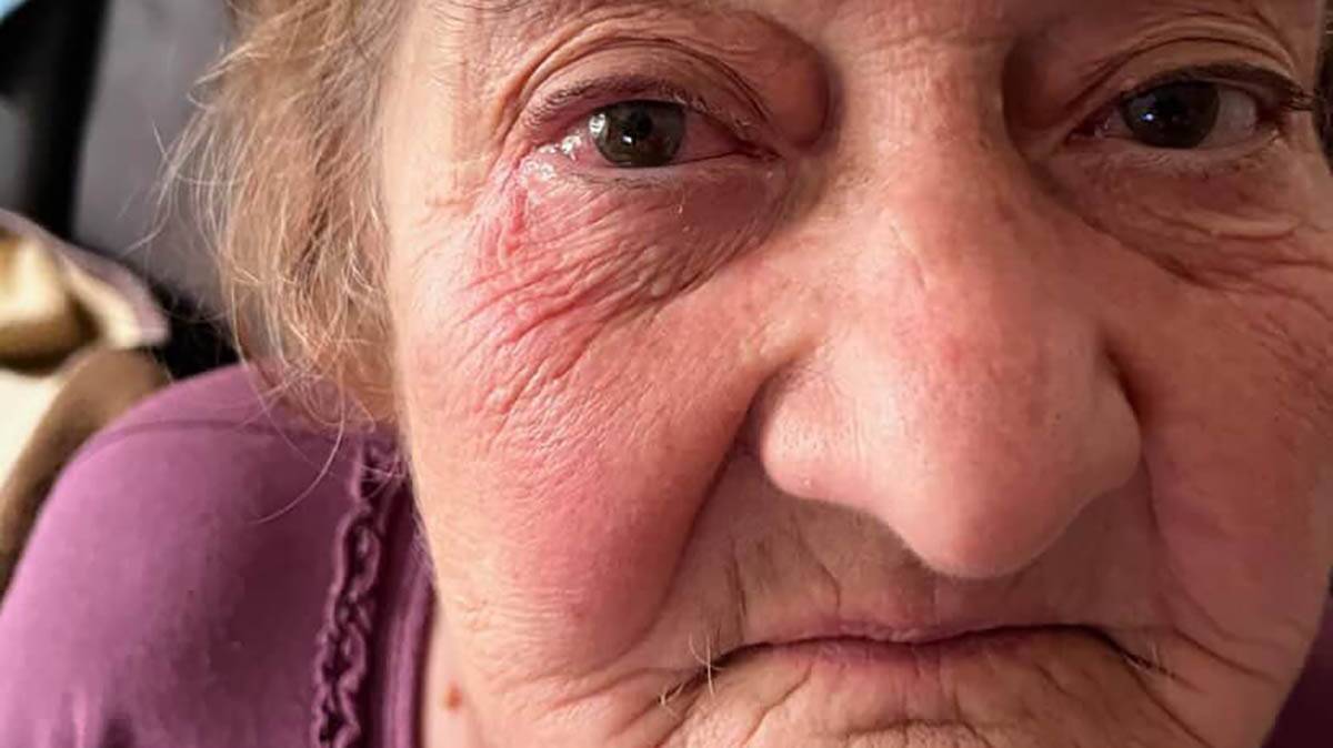 Nestala baka (80) u Nišu, poslednji put viđena u petak na Matejevačkom putu: Porodica moli za pomoć (Foto)