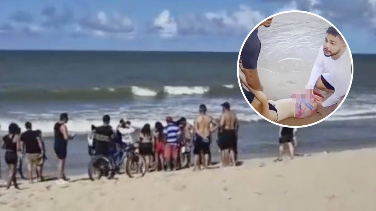 Horor na popularnoj plaži - ajkula odgrizla nogu devojci u B