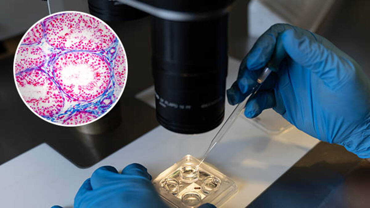"Mladima je loš spermogram zbog 3 stvari": Doktori su nam pokazali kako izgleda plodnost pod mikroskopom