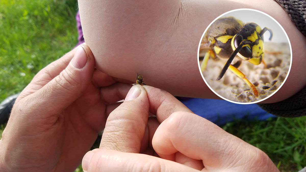 Kako je moguće da neko umre od uboda ose? Beograđaninu nije bilo spasa, a ovo su znaci reakcije opasne po život