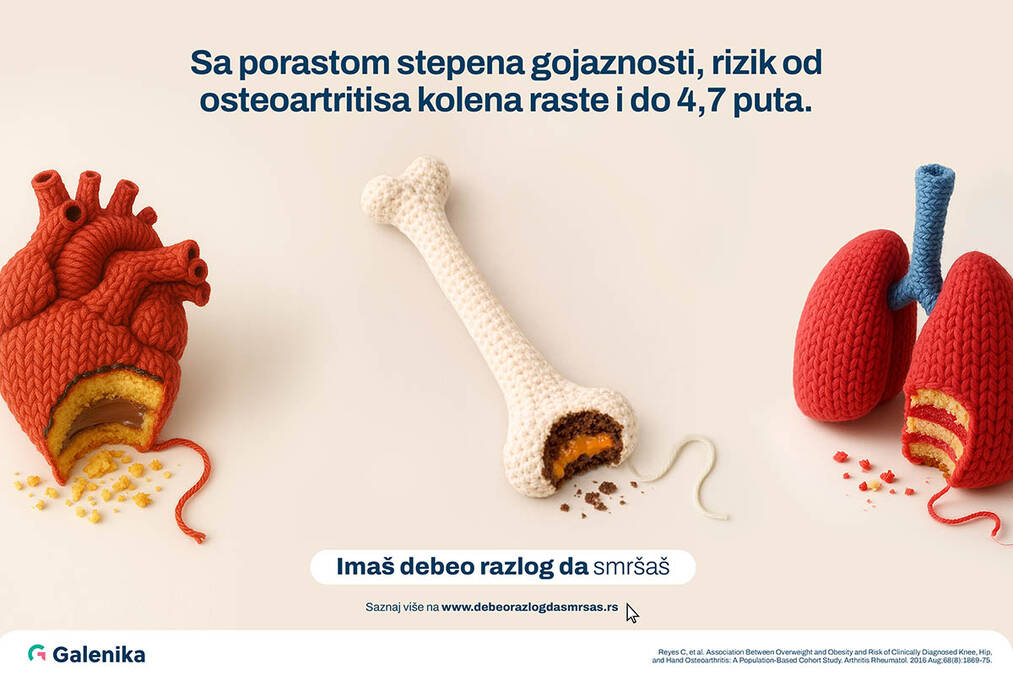 Šta se zapravo dešava sa mišićima kada mršavimo?