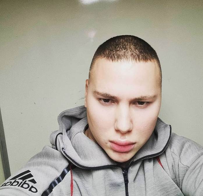 Plastične operacije Brendona Radonjića