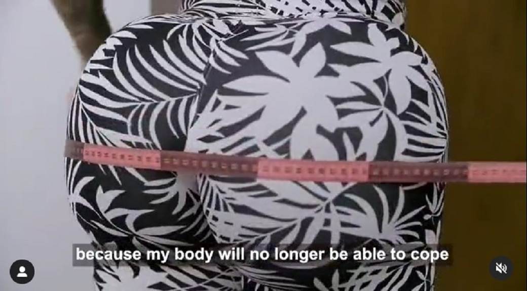 najveca prirodna guza na svetu vanessa ataides