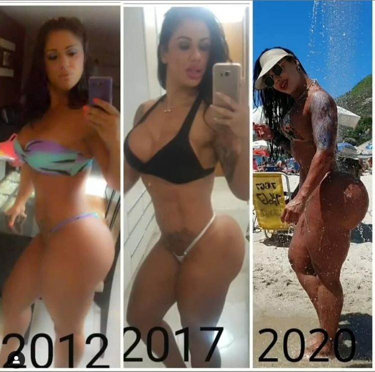 najveca prirodna guza na svetu vanessa ataides