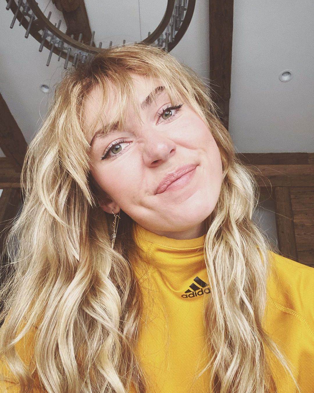 Aleksander Omot Kilde pokazao šavove nakon teške povrede fotografije