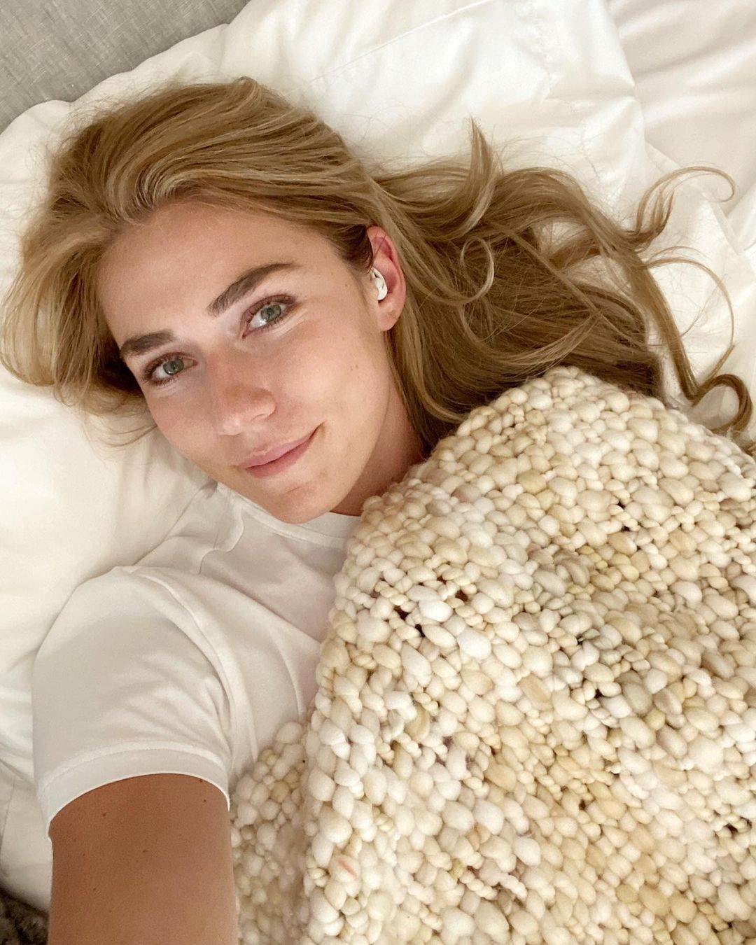 Aleksander Omot Kilde pokazao šavove nakon teške povrede fotografije