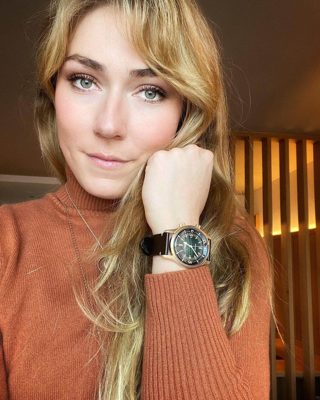 Aleksander Omot Kilde pokazao šavove nakon teške povrede fotografije