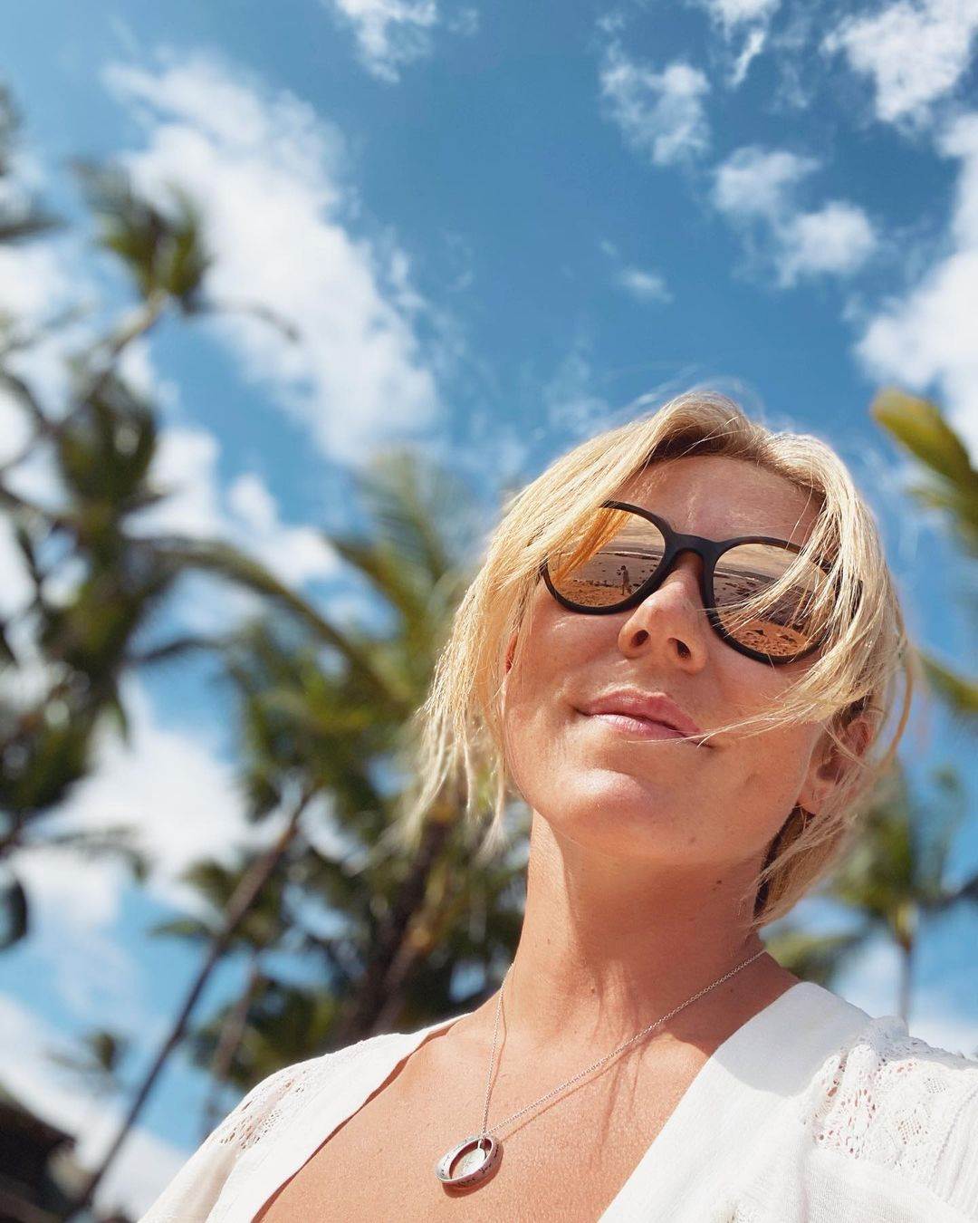 Aleksander Omot Kilde pokazao šavove nakon teške povrede fotografije