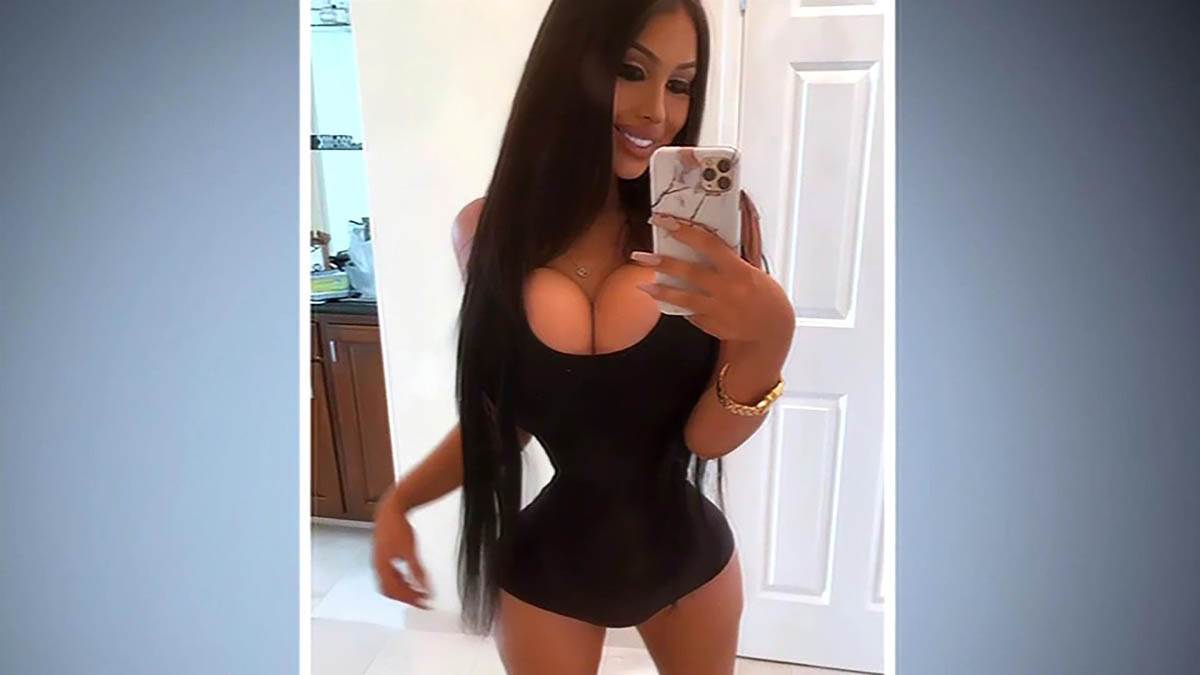 Devojka potrošila milion dolara na operacije 