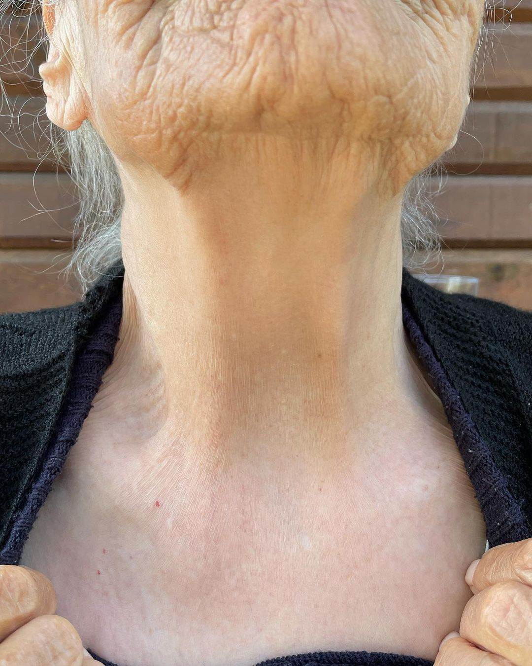 kako izgleda koza izlozena suncu