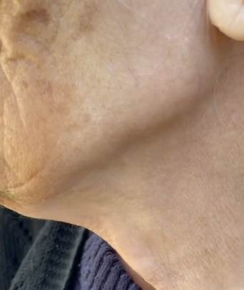 kako izgleda koza izlozena suncu