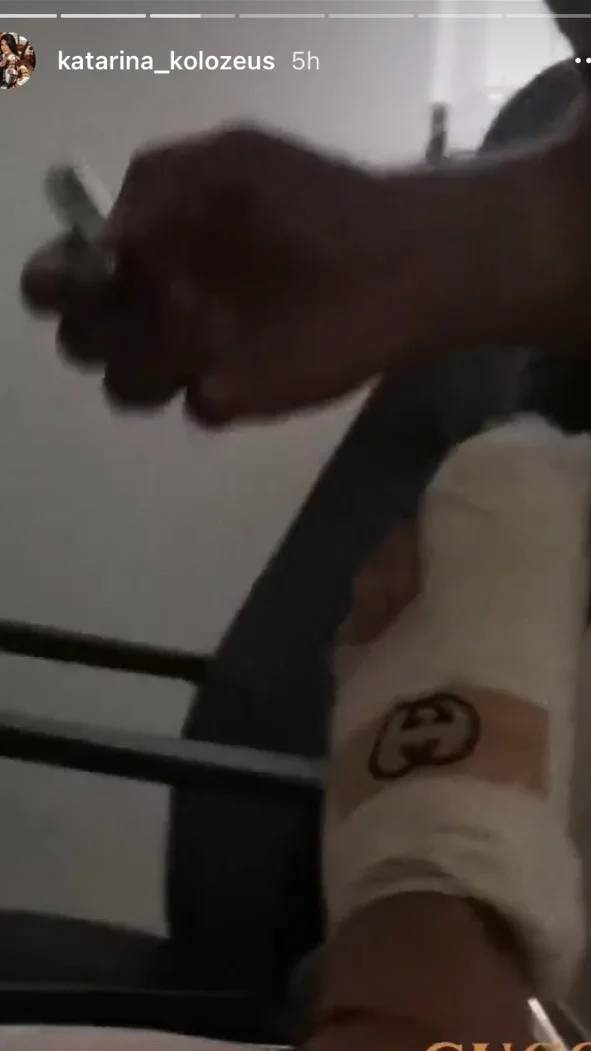 ljuba perucica zena u gipsu