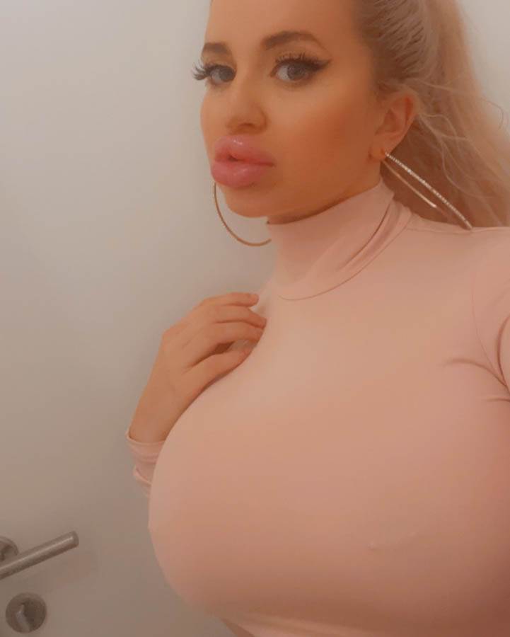 plasticne operacije bratz lutka