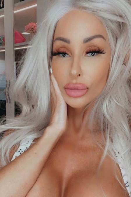 estetska hirurgija slike pre i posle