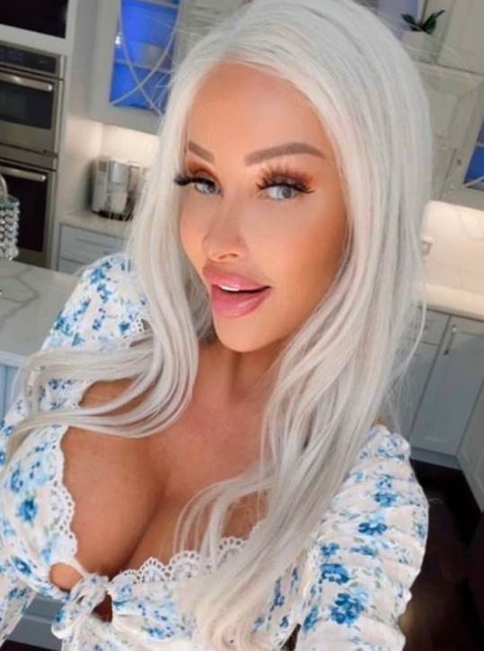 estetska hirurgija slike pre i posle