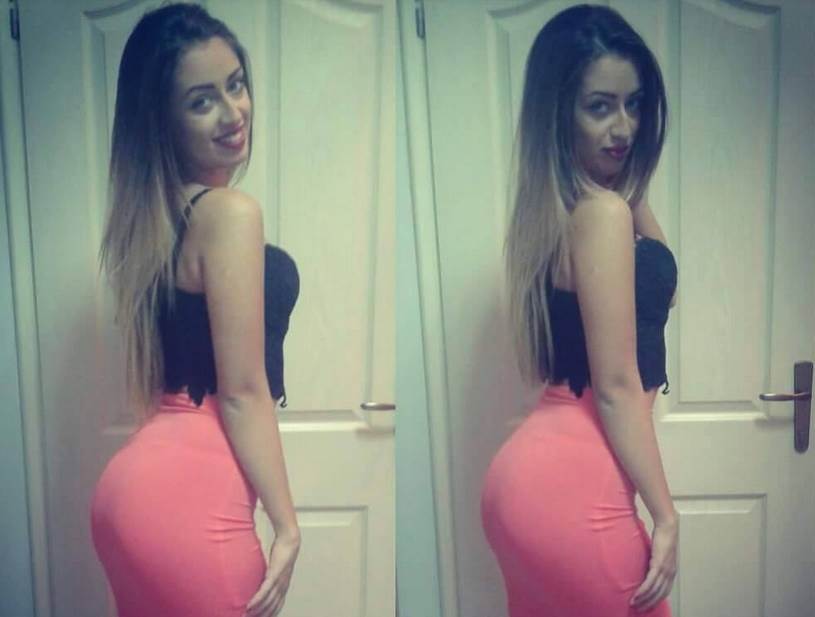 Tea Tairović pre plastičnih operacija