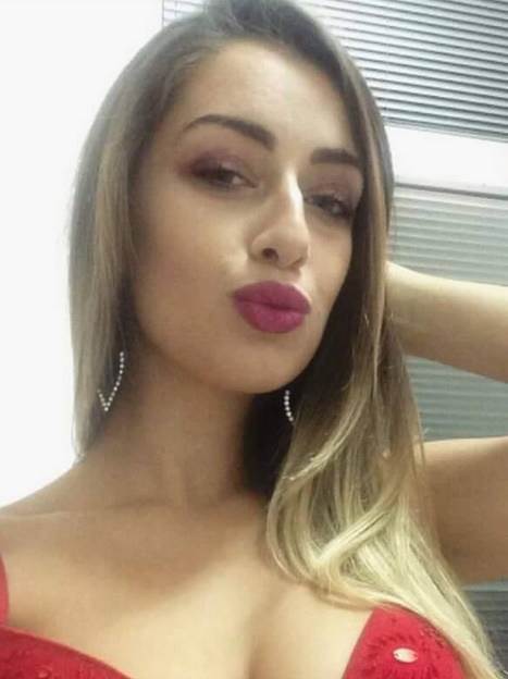 Tea Tairović pre plastičnih operacija