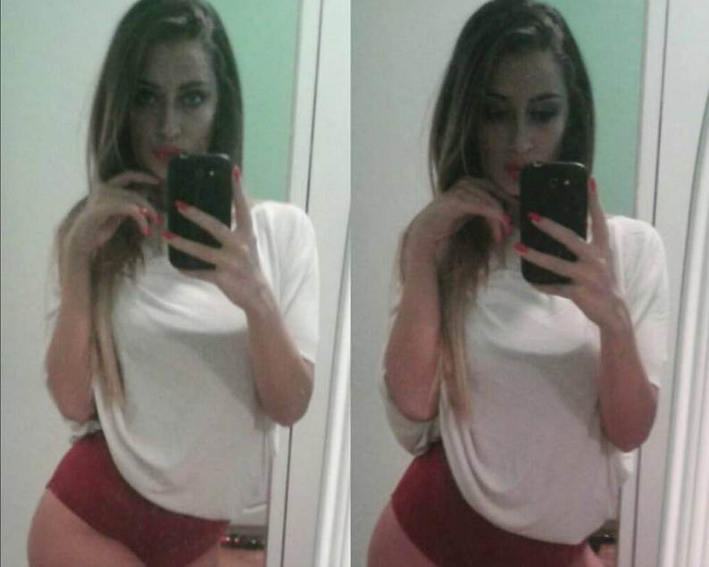 Tea Tairović pre plastičnih operacija