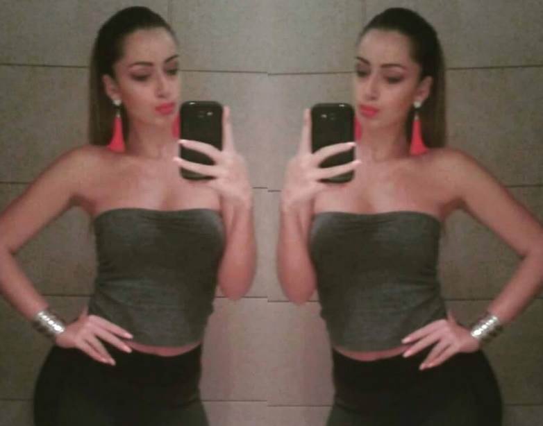 Tea Tairović pre plastičnih operacija