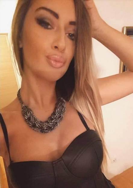 Tea Tairović pre plastičnih operacija