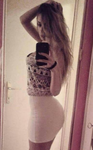 Tea Tairović pre plastičnih operacija