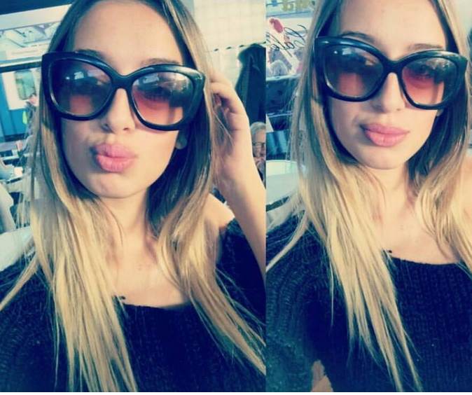 Tea Tairović pre plastičnih operacija