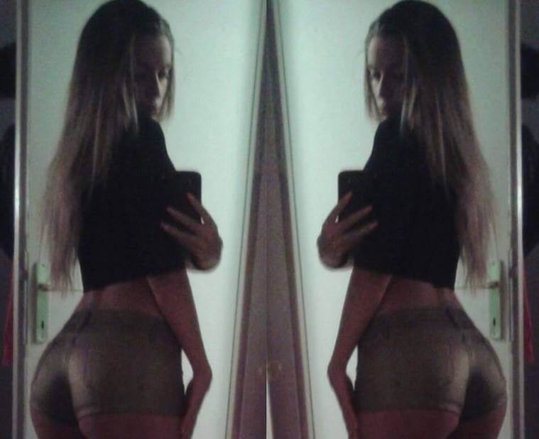 Tea Tairović pre plastičnih operacija