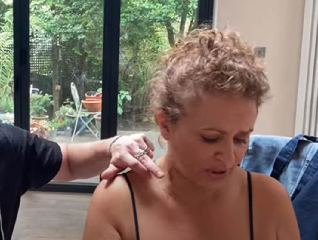 voditeljka opekotine med