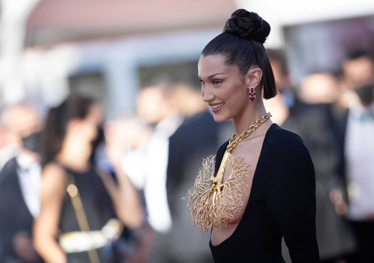 Plastični hirurg o devojkama koje traže lice Bele Hadid