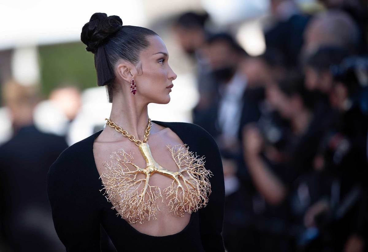 Plastični hirurg o devojkama koje traže lice Bele Hadid