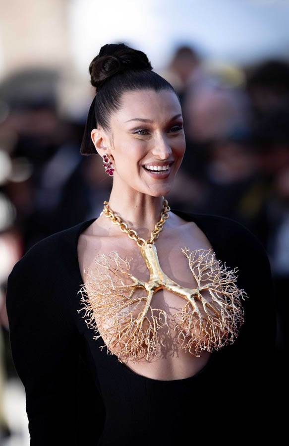 Plastični hirurg o devojkama koje traže lice Bele Hadid