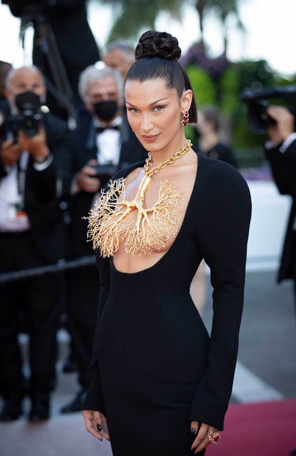 Plastični hirurg o devojkama koje traže lice Bele Hadid