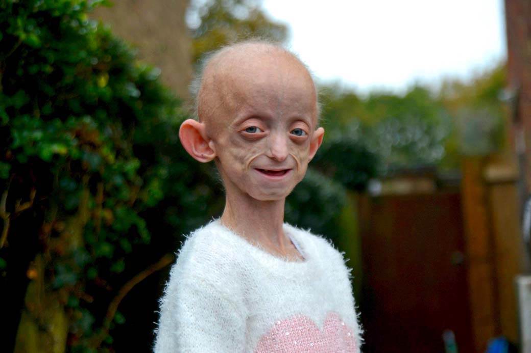 Preminula devojčica u Engleskoj