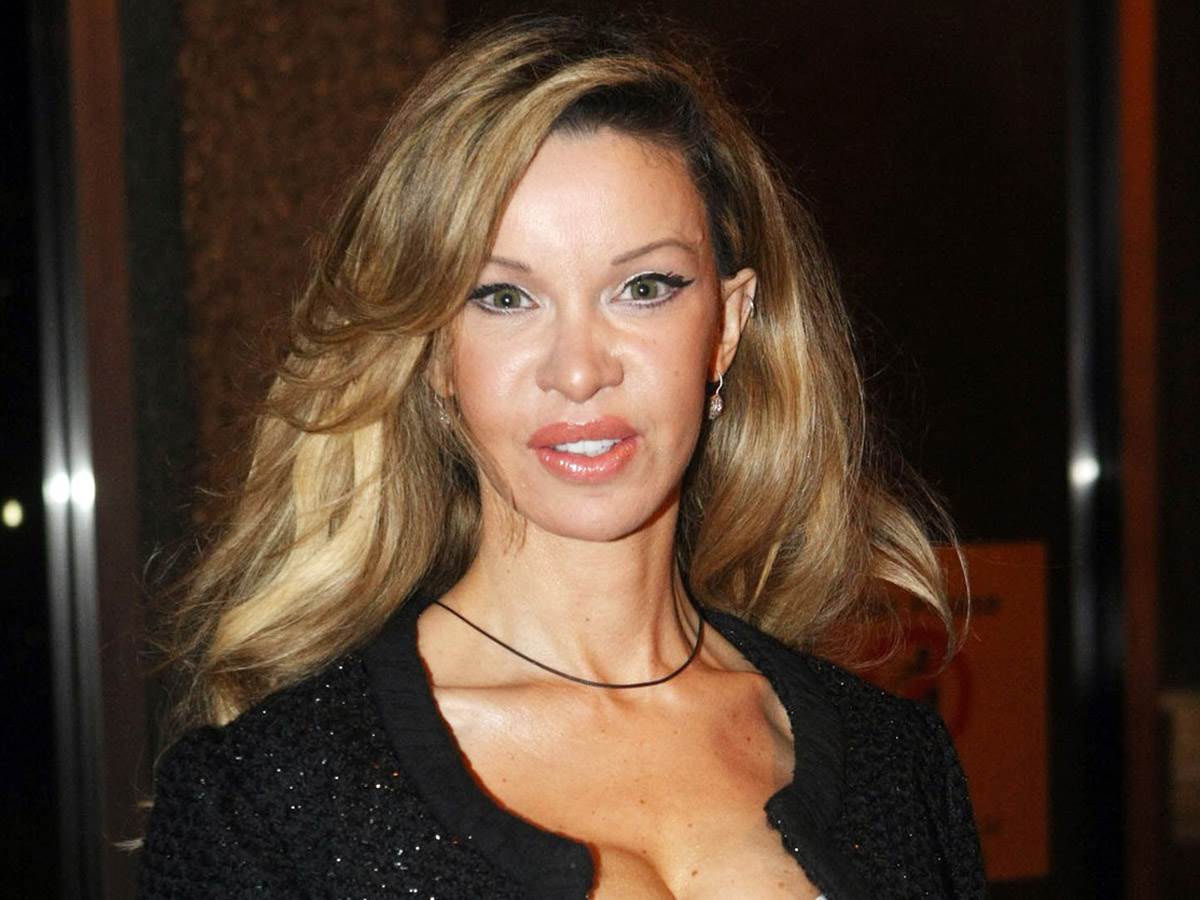 Ališa Duval imala 360 plastičnih operacija