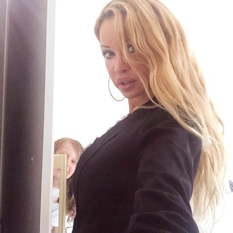 Ališa Duval imala 360 plastičnih operacija