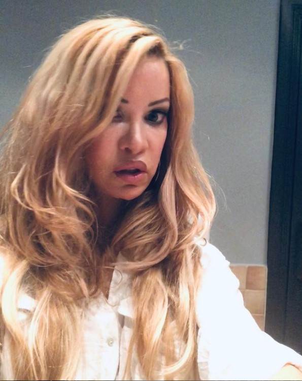 Ališa Duval imala 360 plastičnih operacija