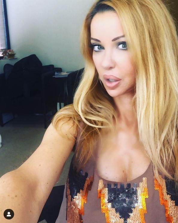 Ališa Duval imala 360 plastičnih operacija