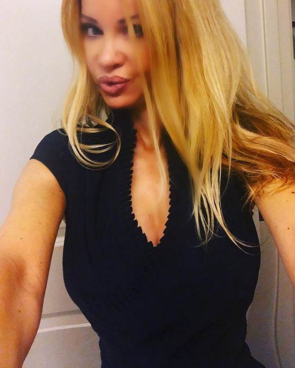 Ališa Duval imala 360 plastičnih operacija