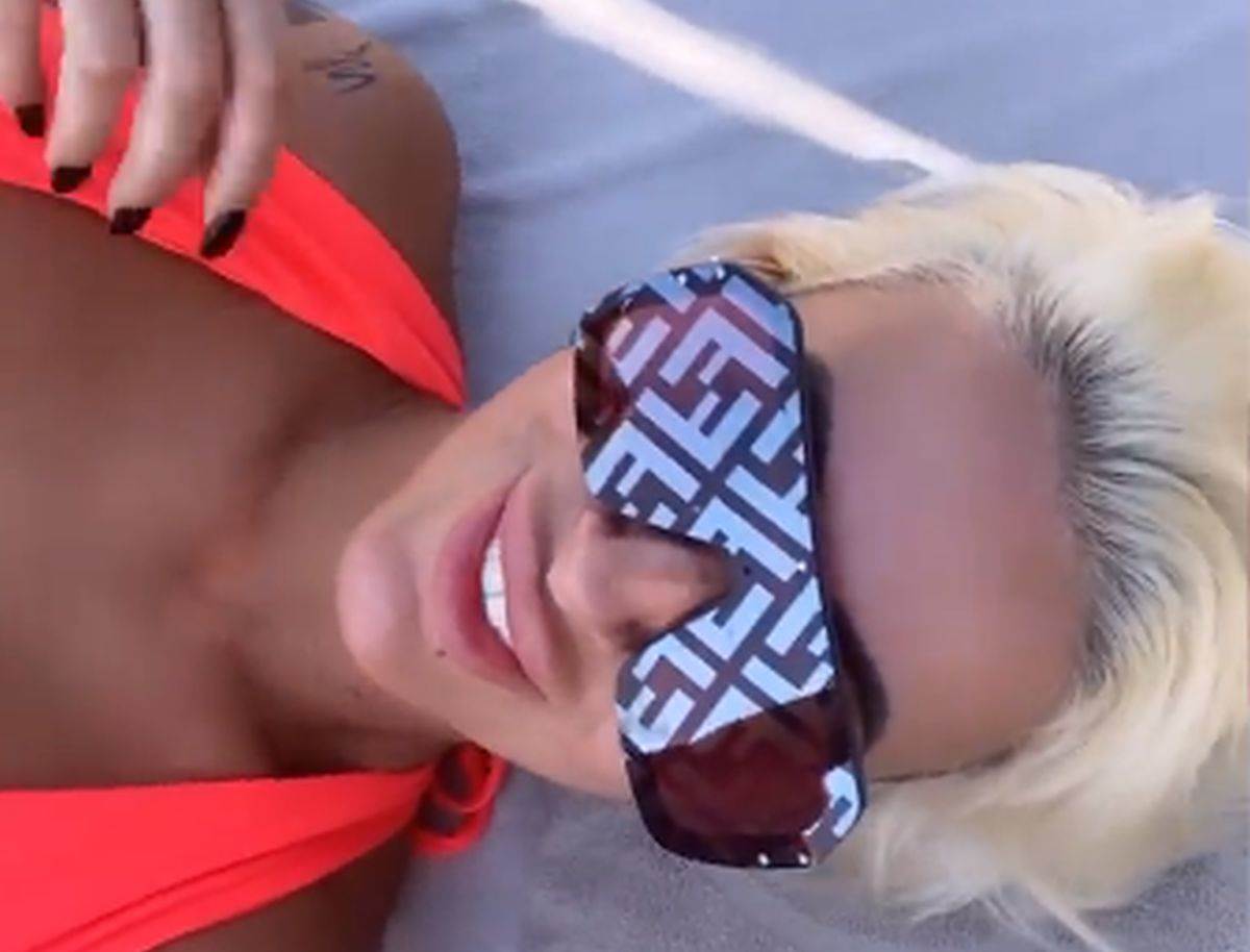 Dušica Jakovljević pokazala masnice na ruci