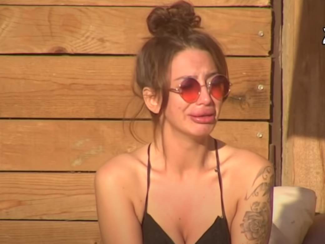 Aleksandra Nikolić pokazala vađenje silikona iz usana