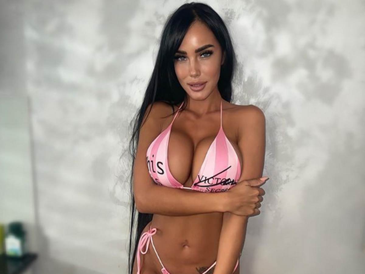 Aleksandra Subotić u modricama i ožiljcima