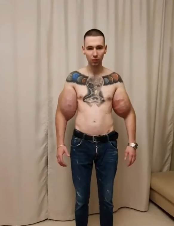 rus povecao bicepse7