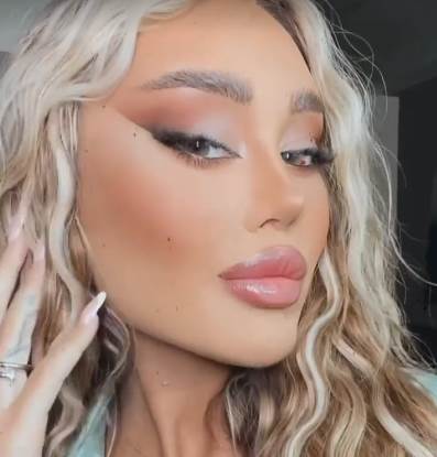 Ana Korać plastične operacije uradila mačije oči