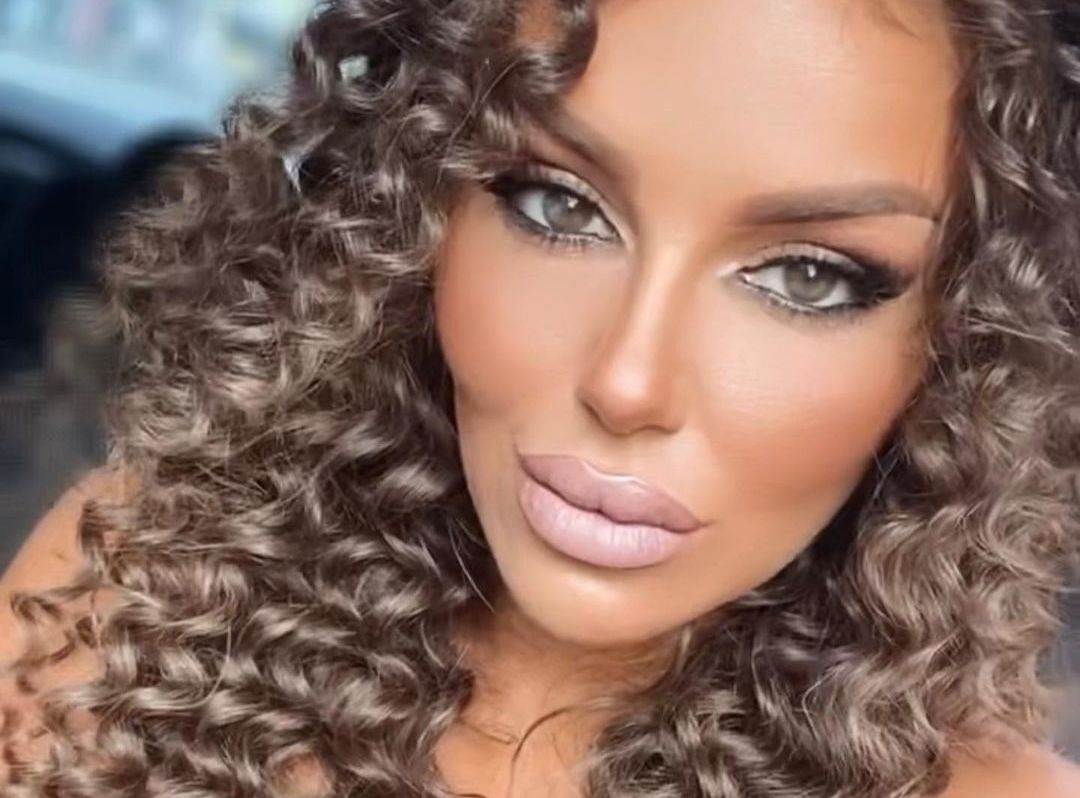 Nataša Rodić plastične operacije kako sada izgleda